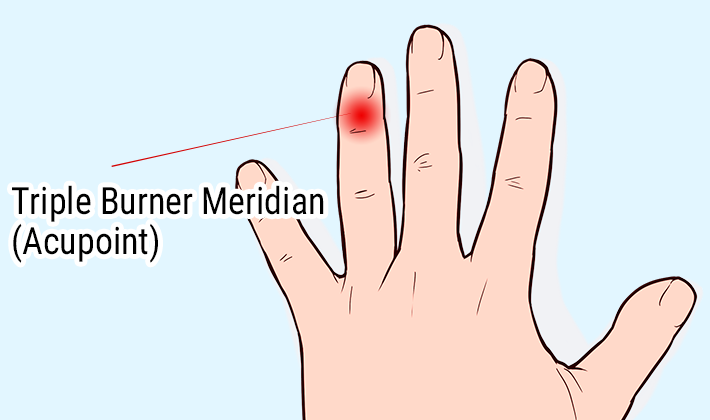 Triple Burner Meridian (Acupoint)